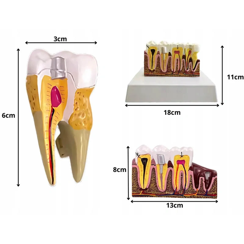 Anatomický model zubov na štúdium